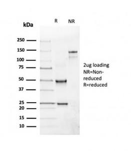 SDS-PAGE analysis of Anti-CD19 Antibody [rCD19/4591] under non-reduced and reduced conditions; showing intact IgG and intact heavy and light chains, respectively. SDS-PAGE analysis confirms the integrity and purity of the antibody.