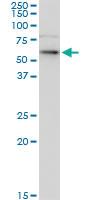 Anti-CK6B Mouse Monoclonal Antibody [clone: 1C4]