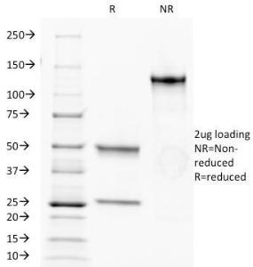 SDS-PAGE analysis of Anti-CD34 Antibody [HPCA1/1171] under non-reduced and reduced conditions; showing intact IgG and intact heavy and light chains, respectively. SDS-PAGE analysis confirms the integrity and purity of the antibody.