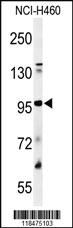 Anti-PLG Rabbit Polyclonal Antibody