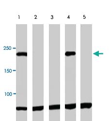 Anti-SMARCA2 Rabbit Polyclonal Antibody