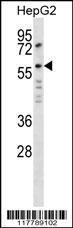 Anti-ANGPT2 Rabbit Polyclonal Antibody (FITC (Fluorescein Isothiocyanate))