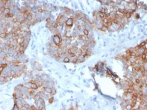 Anti-STAT2 Mouse Monoclonal Antibody [clone: STAT2/2650]