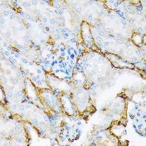 Anti-alpha 2 Macroglobulin Rabbit Monoclonal Antibody [clone: ARC1734]