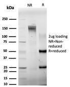 Antibody anti-ELK1 pcrp-ELK1-1D9 100 µg