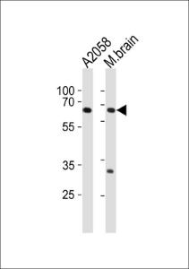 Anti-LZTS1 Rabbit Polyclonal Antibody (FITC (Fluorescein Isothiocyanate))