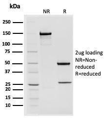 Anti-STAT2 Mouse Monoclonal Antibody [clone: STAT2/2650]