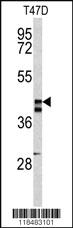 Anti-SERPINA3 Rabbit Polyclonal Antibody