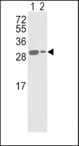 Anti-APRT Rabbit Polyclonal Antibody (Biotin)