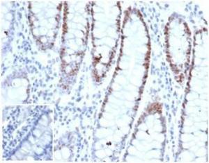 Immunohistochemical analysis of formalin-fixed, paraffin-embedded human small intestine tissue using Anti-MSH6 Antibody [rMSH6/6846]