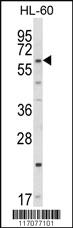 Anti-STK25 Rabbit Polyclonal Antibody