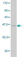 Anti-SSR4 Mouse Monoclonal Antibody [clone: 2D3]