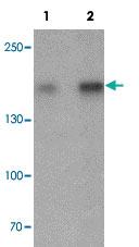 Anti-KCP Rabbit Polyclonal Antibody