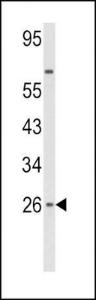 Anti-Interferon beta Rabbit Polyclonal Antibody (AP (Alkaline Phosphatase))