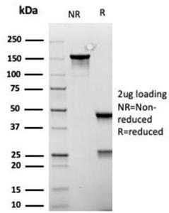 SDS-PAGE analysis of Anti-MSH6 Antibody [rMSH6/6846] under non-reduced and reduced conditions; showing intact IgG and intact heavy and light chains, respectively. SDS-PAGE analysis confirms the integrity and purity of the Antibody