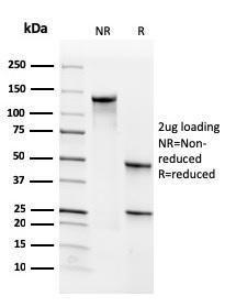 SDS-PAGE analysis of Anti-CD34 Antibody [SPM610] under non-reduced and reduced conditions; showing intact IgG and intact heavy and light chains, respectively. SDS-PAGE analysis confirms the integrity and purity of the antibody