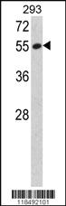 Anti-SERPINF1 Rabbit Polyclonal Antibody