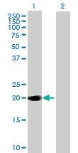 Anti-DUSP14 Mouse Polyclonal Antibody