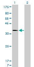 Anti-MDM2 Mouse Monoclonal Antibody [clone: 1A7]