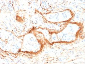 Immunohistochemical analysis of formalin-fixed, paraffin-embedded human small intestine using Anti-Elastin Antibody [ELN/1981]