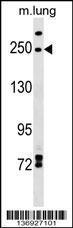 Anti-INF2 Rabbit Polyclonal Antibody (AP (Alkaline Phosphatase))