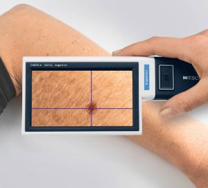 Mobilux® digital magnifier, healthcare application