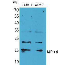 Western blot analysis of HL 60, 22RV 1 cells using Anti-CCL4 Antibody