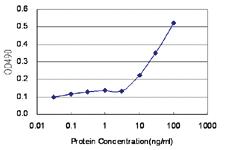 Anti-PAX6 Polyclonal Antibody Pair