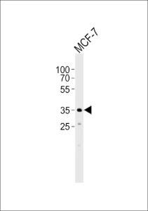 Anti-FBXL17 Rabbit Polyclonal Antibody