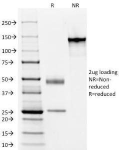 SDS-PAGE analysis of Anti-Elastin Antibody [ELN/1981] under non-reduced and reduced conditions; showing intact IgG and intact heavy and light chains, respectively. SDS-PAGE analysis confirms the integrity and purity of the antibody.