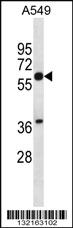 Anti-SQLE Rabbit Polyclonal Antibody