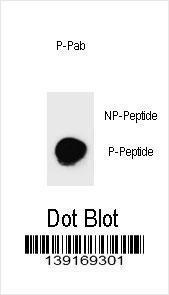 Anti-PARP1 Rabbit Polyclonal Antibody (Biotin)