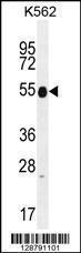 Anti-KRT25 Rabbit Polyclonal Antibody (APC (Allophycocyanin))