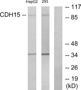 Western blot analysis of lysates from HepG2 and 293 cells using Anti-CDH15 Antibody. The right hand lane represents a negative control, where the antibody is blocked by the immunising peptide