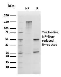 SDS-PAGE analysis of Anti-SOX2 Antibody [rSOX2/1792] under non-reduced and reduced conditions; showing intact IgG and intact heavy and light chains, respectively. SDS-PAGE analysis confirms the integrity and purity of the Antibody