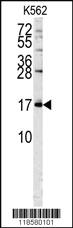 Anti-POLE3 Rabbit Polyclonal Antibody