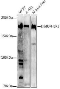 Antibody anti-ERBB3 100 µl