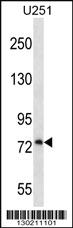 Anti-PLOD1 Rabbit Polyclonal Antibody