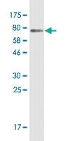 Anti-NAPRT Mouse Monoclonal Antibody [clone: 4A9]