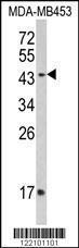 Anti-Interferon gamma Receptor Chain 2 Rabbit Polyclonal Antibody (APC (Allophycocyanin))