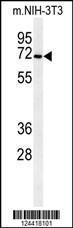 Anti-CSGALNACT1 Rabbit Polyclonal Antibody (APC (Allophycocyanin))