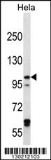 Anti-IREB2 Rabbit Polyclonal Antibody