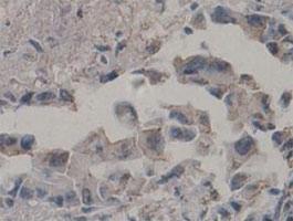 Anti-CASP7 Rabbit Polyclonal Antibody