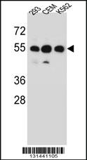 Anti-ZNF562 Rabbit Polyclonal Antibody