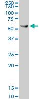 Anti-CK8 Mouse Polyclonal Antibody