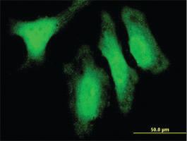 Anti-DUSP14 Mouse Monoclonal Antibody [clone: 4B5-E6]