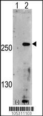 Anti-PIKFYVE Rabbit Polyclonal Antibody