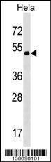 Anti-NCR3LG1 Rabbit Polyclonal Antibody (FITC (Fluorescein Isothiocyanate))