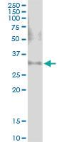 Anti-CACUL1 Polyclonal Antibody Pair