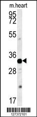 Anti-AQP11 Rabbit Polyclonal Antibody